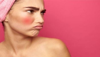 علاج احمرار الوجه